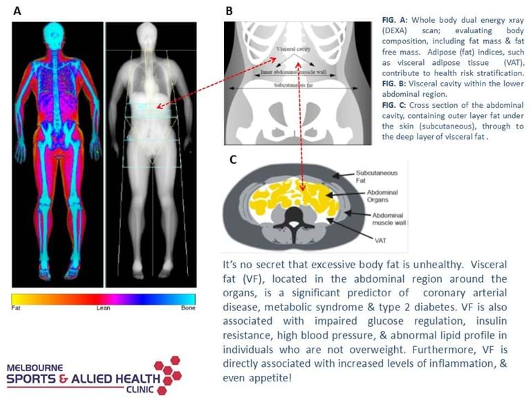 abdominal fat and health risk