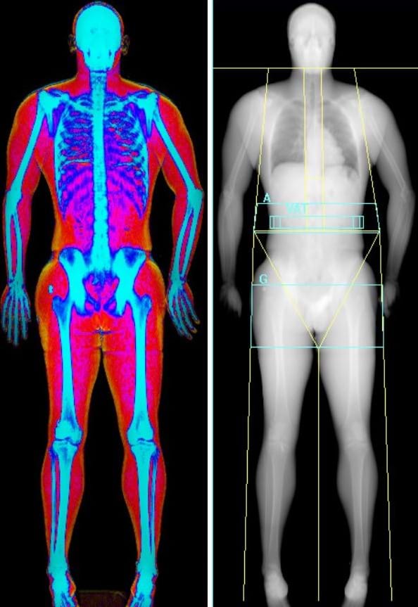 Athlete monitoring │VO2max │ DEXA │ training │recovery │peak ...